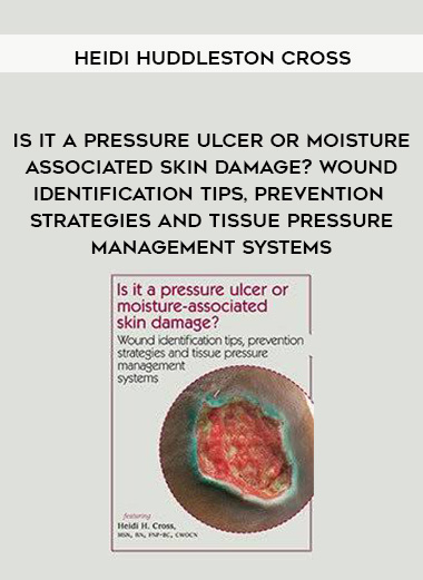 Is it a pressure ulcer or moisture-associated skin damage? Wound identification tips